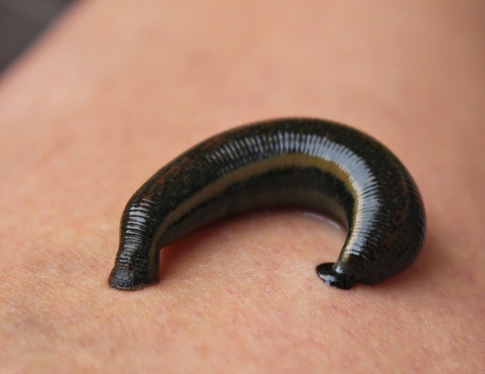 Гирудотерапия - Санаторий «Самшитовая роща»